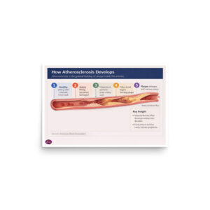 How Atherosclerosis Develops