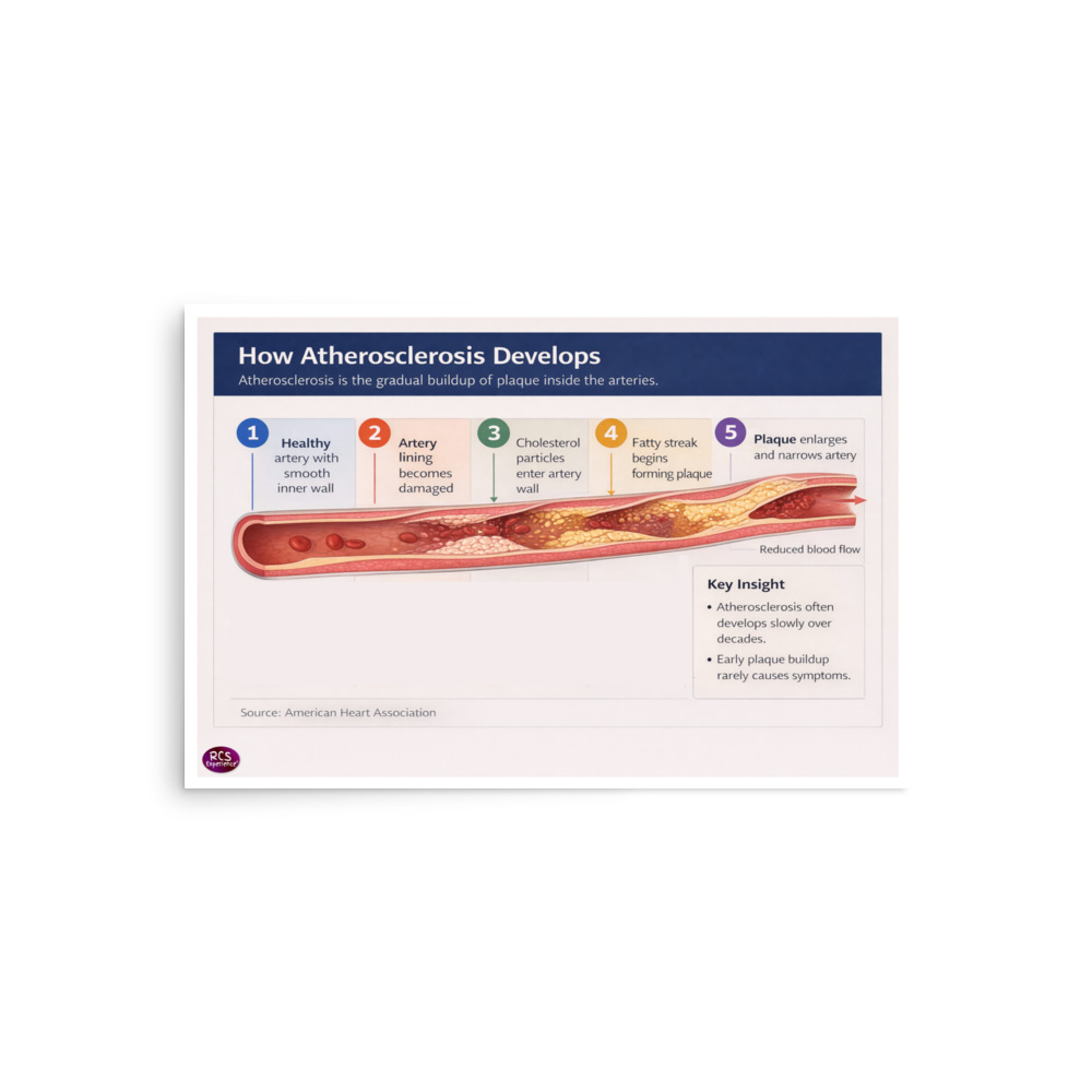 How Atherosclerosis Develops 2 How Atherosclerosis Develops - Image 2
