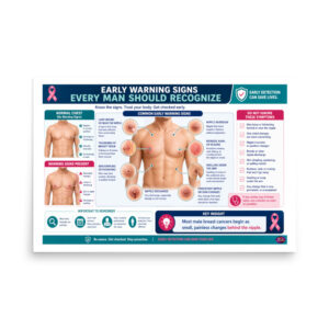 Male Breast Cancer: Early Warning Signs