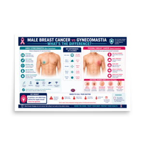 Male Breast Cancer vs Gynecomastia