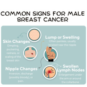 Male Breast Cancer Posters