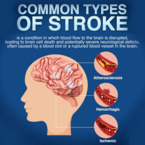 Strokes In Men Posters